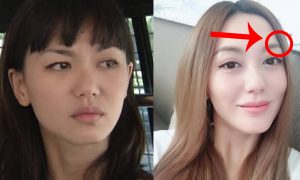 Ciri Orang Memakai Susuk Pemikat