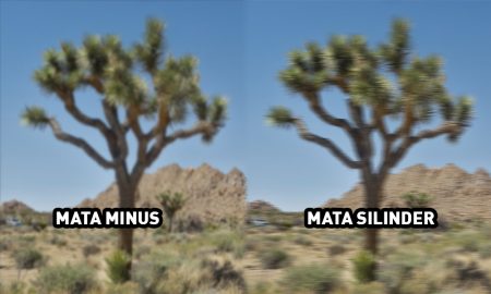 Perbedaan Mata Minus dan Silinder