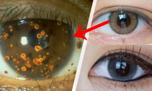 Tips Sebelum Beli Softlens