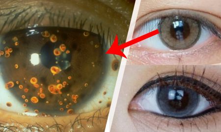 Tips Sebelum Beli Softlens