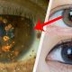 Tips Sebelum Beli Softlens