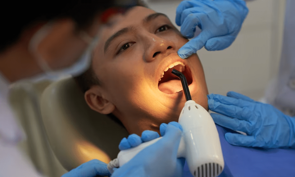 Cara Mengatasi Gigi Berlubang