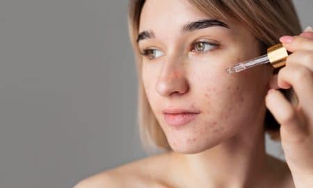 Cara Menghilangkan Bruntusan di Hidung