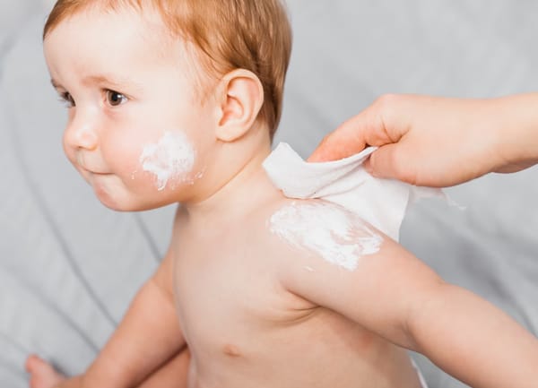 Cara Menghilangkan Bruntusan di Pipi Bayi