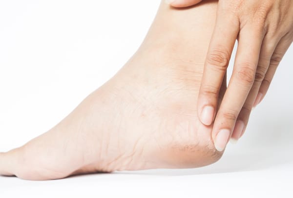 Cara Menghilangkan Kapalan di Kaki
